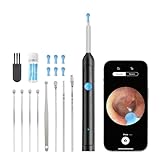 camera connection kit ipad non reconnu 【Compatibilité Universelle】Cet otoscope sans fil se connecte facilement via Wi-Fi aux smartphones et tablettes Android et iOS. Grâce à sa puce de contrôle thermique intégrée, il prévient toute surchauffe. Utilisez-le pour examiner le conduit auditif, la gorge, le nez ou la peau. Un outil polyvalent pour veiller sur votre santé et celle de vos proches.Téléchargez l’application via QR code, maintenez le bouton enfoncé pour allumer et connectez l’otoscope en WiFi.