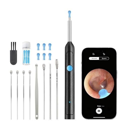 Aihoom Oreille 1080P HD Camera Oreille Nettoyage avec 6 LED Lumières, Kit de Nettoyage d'Oreilles avec 9 Accessoires - Cure-Oreilles Électrique pour Adulte - Compatible iOS & Android (Noir Brillant)