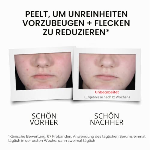 Neutrogena Clear & Defend+ Daily Serum (1 x 30 ml), Verfeinerndes und klärendes Gesichtsserum mit Salicylsäure, AHA/PHA… – Ansicht 4
