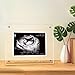 DEYIXUN Acrylic Ultrasound Picture Frame, Bright Photo Frame, Sonogram Love at First Sight Baby Keepsake Baby Announcement, Birth Information, Expecting Mom Parents to be Unique Gifts for Pregnant