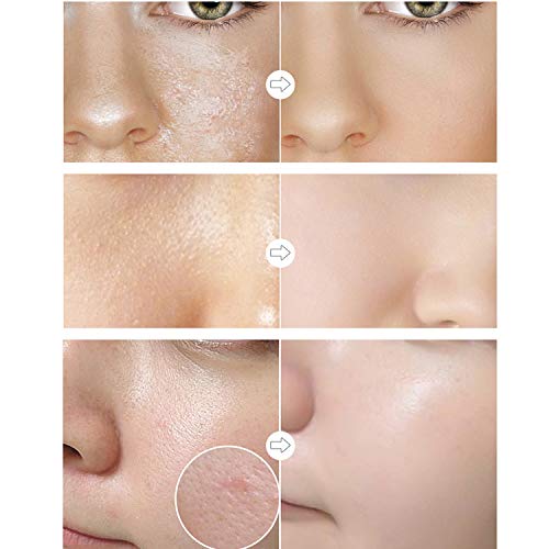 Full Coverage Concealer With Primer Makeup Set, Waterproof Smooth Matte Flawless Foundation Concealer Corrector Makeup Kit For Women Dark Circles Acne (2×6Ml/0.2Fl Oz) #TOP5