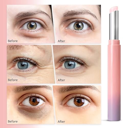 Elsophie Dark Circles Under Eye Treatment: Retinol Eye Cream Under Eye Brightener Stick For Eye Bags Wrinkle Dark Circle And Puffiness thumb #4