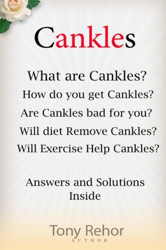 Cankles: This Guide will answer all of your Cankles questions Cankles: This Guide will answer all of your Cankles questions