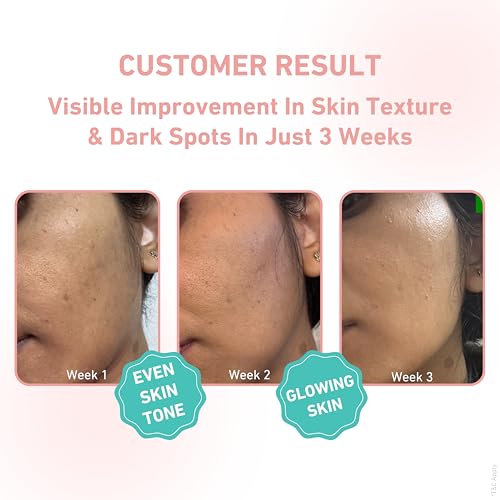 Image of Prettyme Tulsi Face Moisturizer & Night Cream Combo - 100ml | Reduces Dark Spots & Pigmentation, Anti Aging, Skin Repair, Fights Acne, Clear & Fresh Skin | Set of 2: Day Cream, Night Gel