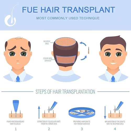 Solución para la pérdida de cabello con extractor de folículos de alta precisión 5