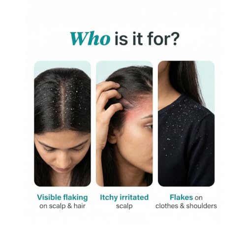 Image of Ravel PRO Anti-Dandruff Lotion+Anti-Dandruff Shampoo (Combo Pack) | Zero Flake Technology | 100% Overnight Flake Elimination - Paraben-Free, Color-Safe | For Men & Women | For All Hair Types