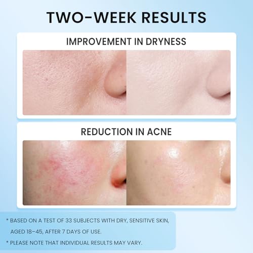 Moisturiser Face Care Cream For Mens & Women, Day & Night Moisturizer, Skin Barrier Repair Moisturisers With Ceramide, Collagen, Hyaluronic Acid & Centella, For Dry Sensitive Skin (2 pcs) - Image 3