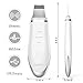 Skin Scrubber Ultrasonic Face Spatula, Hailicare Pore Cleanser Comedone Extractor, Blackhead Remover Acne Spatula for Deep Clean, Facial Exfoliation Moisturizing Lifting Treatment