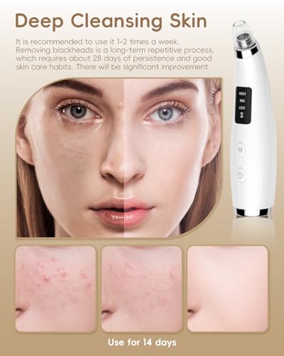 facial pore blackhead remover vacuum - fore cleaner and blackhead extractor with 3 adjustable suction levels - 5 probes - pore vacuum kit for womenampmen white