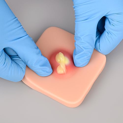 Image of Ultrassist Abscess I&D Incision and Drainage Pad (6-Pack), Sebaceous Cyst Removal Trainer, Suture Practice Skin Pad for Medical Education