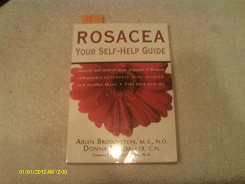 Rosacea view 2