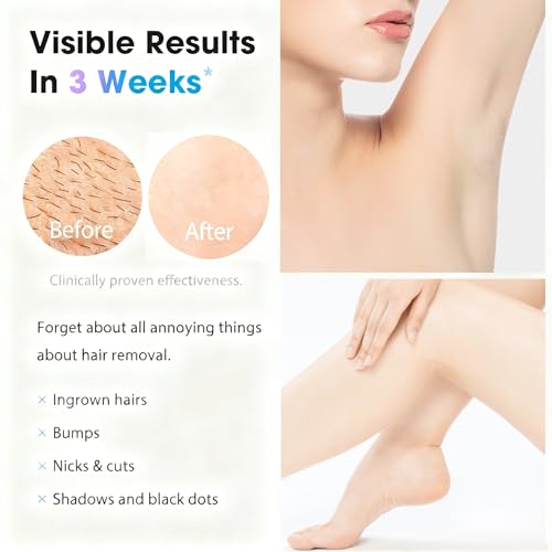 Image of IPL Laser Hair Removal Device for Women & Men - At-Home Painless Ultra-Fast Flash Hair Remover, 86% Hair Reduction in 4 Weeks, High Energy & 5 Modes, 8 Mins Full Body & Bikini Line & More, Corded