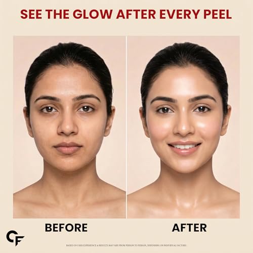 Image of Carbamide Forte Collagen Peel Off Mask for Korean Glass Skin | Collagen mask overnight with Hyaluronic Acid, Niacinamide & Ceramide NP | Pore Minimizing, Firming & Skin Brightening Mask | For All Skin Types | 100 ml