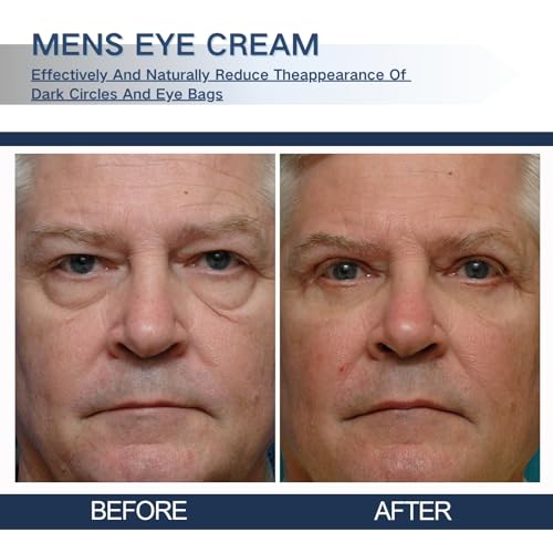 Trendyfave Anti Wrinkle Eye Cream, Retinol Eye Cream For Eye Bags & Dark Circles, Diminishing Deep Wrinkles And Fine Lines Caffeine Eye Cream, Eye Contour Firming Eye Cream, Mens Eye Cream - Image 5