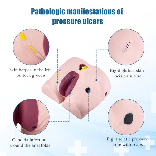 Image of JNMFTD Geriatric Decubitus Ulcer Nursing Model, 4 Stages Pressure Ulcers Advanced Nursing Elderly Bedsore Human Model Wound Kit with Product Manual Card for Hospital Medical Education Study
