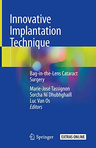 livre Innovative Implantation Technique: Bag-in-the-lens Cataract Surgery