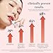 NOONI Korean Lip Oil - Appleginseng | Lip Stain, Long-Lasting, Moisturizing, Plumping, Revitalizing for Dry Lips, Waterproof, No Peel Off, Korean Lip Tint, Stocking Stuffers, Cute Things, 0.12 Fl Oz