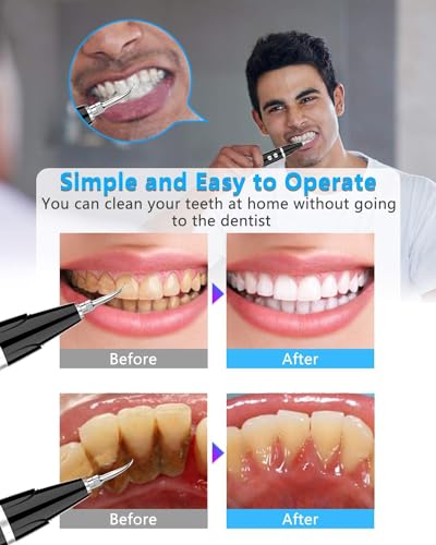 Higiene Bucal Y Dental, Personal Care Appliances Imagen adicional