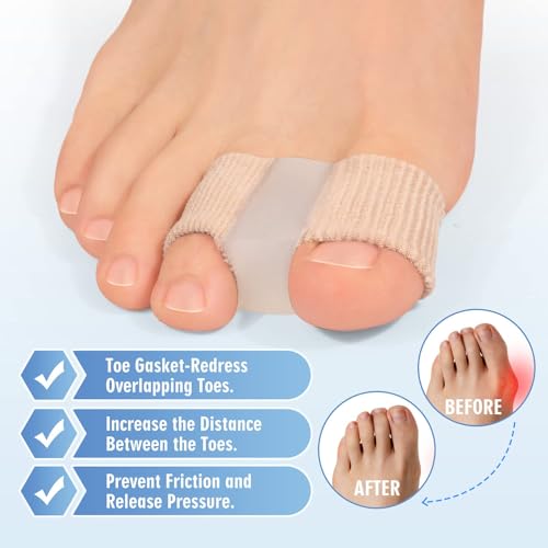 Image of Inralimot 2 Pcs Bunions Gel Toe Separators for Overlapping Toes,Toe Spacers Separators, Wicking Breathable Fabric Bunion Corrector with Gel Lining for Bunion Pain Relief and Overlapping Toe