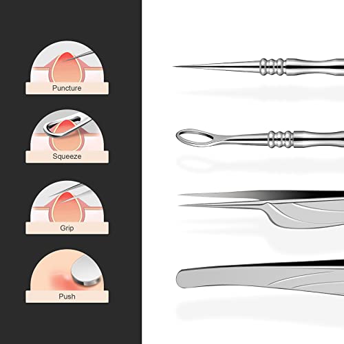BEZOX-Blackhead-Remover-Tools-ALL-Stainless-Steel--Set-of-Blackhead-Tweezers-and-Ance-Needle-with-Comedone-Extractor-High-Temperature-Disinfection-Never-Rust--Easy-Remove-Pimples-Blackheads-Zit