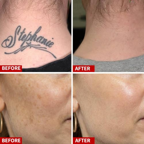 rechargeable red pen with glasses 1 count pack of 1 white