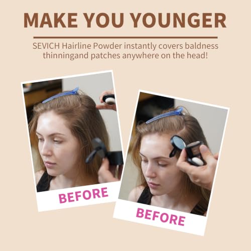 Image of Sevich Hairline Powder, Gray Root Touch Up, Sweatproof, Black