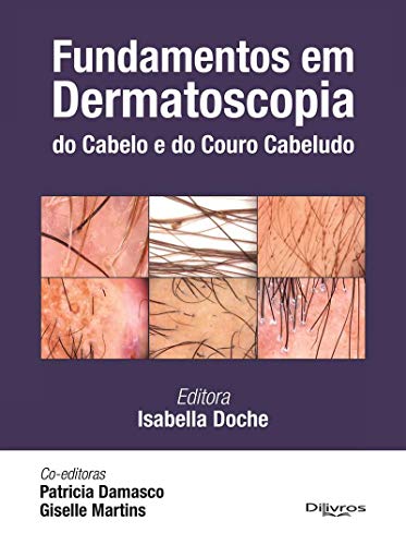 Fundamentos em Dermatoscopia do Cabelo e do Couro Cabeludo