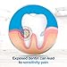 Sensodyne 24/7 Sensitivity Protection Extra Whitening Toothpaste, 6.5 Ounce Tubes (Pack of 3)