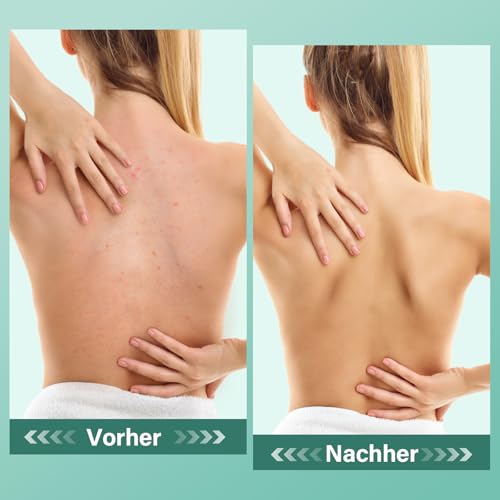 Körperpeeling mit Eukalyptus und Bitterminze, Körperpeeling Damen, Spendet Feuchtigkeit und Pflegt Die Haut, Lindert Muskelverspannungen, Badesalz für Muskelbäder, 300 g