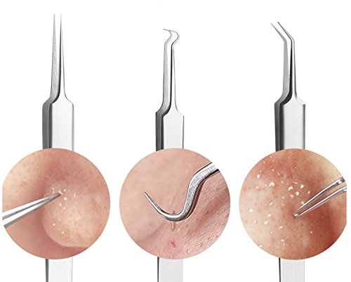 Mitesser-Pinzette Edelstahl Set – 8,7 Cm, Mit Haken-, Schräg- & Gerade-Spitze Für Hautunreinheiten