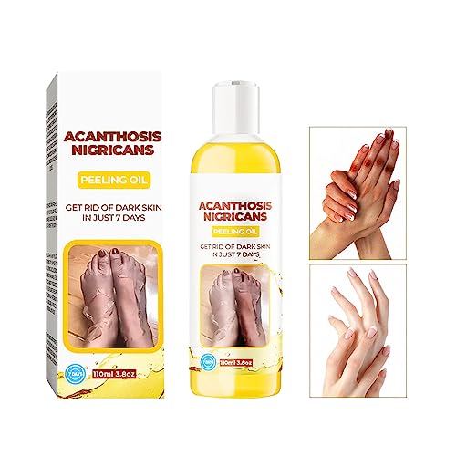 Fengyang® Aceite Peeling Corporal, Aceite Peeling Exfoliante Corporal, Peeling Corporal para Manchas Oscuras Corporales, Blanquear Y Suavizar La EliminacióN De Callos, Tez Iluminadora