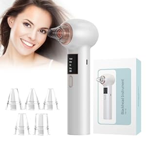 Magitech 2024 Upgraded Blackhead Remover Vacuum, Pore Vacuum Blackhead Remover for Men Women – Blackhead Vacuum with Heating Mode – 3 Suction Power 5 Probes USB Rechargeable Blackhead Vacuum Extractor