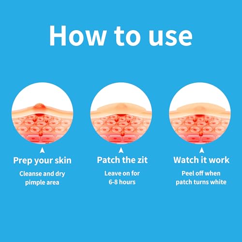 Fxxoee Pimple Patches For Face, 288 Hydrocolloid Patches, Effectively Cover And Repair Acne And Blemishes, Promoting Skin Regeneration. Ideal For Makeup thumb #5