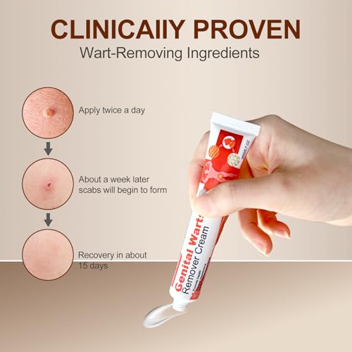 Image of Wart Cream Fast Acting Gel Wart Remover Freeze Off-Fast-Acting Wart's Ointment,genital warts Remover,Foot Warts Corn Removal for Feet Hands for Plantar , Flat , Common , Corn, H Warts, Callus-AAR222