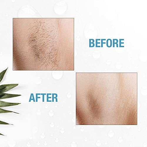 GiGi Clean + Easy Deluxe Electrolysis Home...