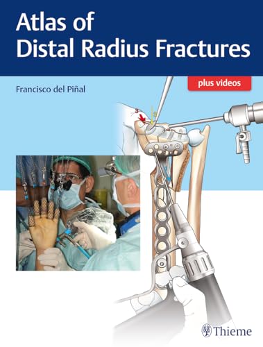 Atlas of Distal Radius Fractures: Plus videos