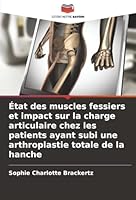 État des muscles fessiers et impact sur la charge articulaire chez les patients ayant subi une arthroplastie totale de la hanche (French Edition) 6202475129 Book Cover