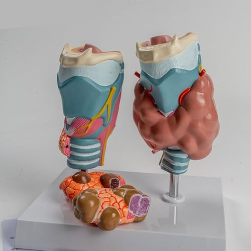 Modèle d'anatomie thyroïdienne pathologique humaine de haute précision - 4