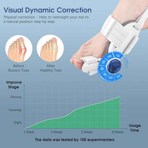 Image of KASHEVI Bunion Corrector for Women & Men Big Toe - Bunion Fix with Big Toe Separator for Toes Alignment - Adjustable Orthopedic Bunions Splint with Straightener for Pain Relief, Hallux Valgus Correction(White)