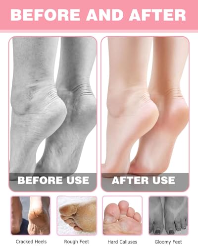 KEMUZ 2 Paar Silikon-Feuchtigkeitssocken,Elastische Silikonsocken für Füße,Anti Rutsch Feuchtigkeits Socken,Fuß Spa Gel Socken für Fußpflege,Repariert Trockene, Rissige Raue Füße