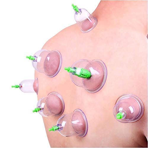Image of 12pcs Bio Magnetic Vacuum Cupping Therapy Set, Professional Chinese Suction Acupuncture Cups with Extension Tube, Deep Tissue Massage and Back Pain Relief Cupping Kit