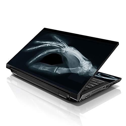 Image of LSS 15 15.6 Inche Laptop Notebook Skin Sticker with 2 Wrist Pads - Reusable Cover Protector Vinyl Sticker Cover Decal Fits 13 inch - 16 inch HP Asus Acer Samsung - Skeloton Hand Scan Pattern