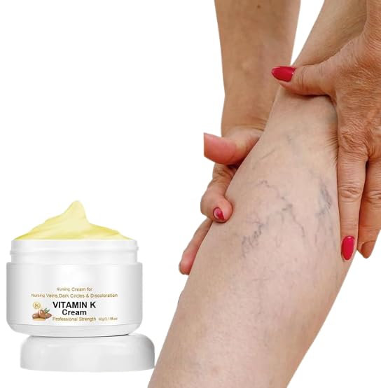 Crema De Vitamina K,Tratamiento De Varices Para Piernas,Crema Calmante Para Piernas Para Aliviar Varices De Arañas Vasculares,Piernas Cansadas Y Pesadas,Hidrata Y Promueve La Circulación Sanguínea