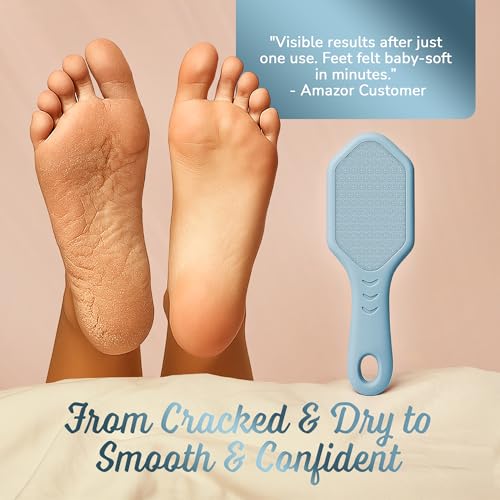 Silicone Foot Callus Remover - Nano Glass Foot File for Dead Skin and Cracked Heels - Callus Remover for Feet & Hard Skin - Ergonomic Foot Scrubber & Exfoliator for Soft, Smooth Feet - Blue