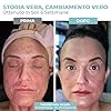 Nourished Bodynskin Maschera di Terapia con Luce LED per Viso & Collo - Dispositivo per la Cura della Pelle del Viso - 7 Colori Rosso & Blu - Ringiovanimento, Prodotto Anti-invecchiamento per le Rughe