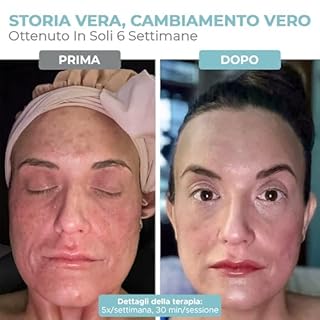 Nourished Bodynskin Maschera di Terapia con Luce LED per Viso & Collo - Dispositivo per la Cura della Pelle del Viso - 7 Colori Rosso & Blu - Ringiovanimento, Prodotto Anti-invecchiamento per le Rughe