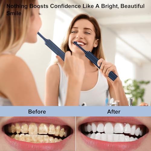 Zahnaufhellungsset, Wbbrbbr Zahnpolierer mit 4 Modi für Zahnreinigung & Zähne Aufhellen, zum Polieren nach der Zahnreinigung, Zahnaufhellung Bleaching Set mit 5 Köpfen und 3 Polierpasten (Blau) – Bild 4