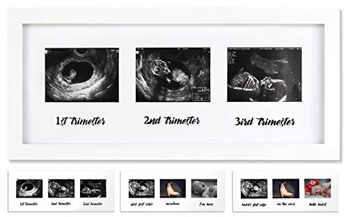 IHEIPYE Triple Sonogram Pregnancy Frame - Baby Ultrasound Picture Frame for Expecting Parents, Baby Shower Frame, Gender Reveal Party, Baby Nursery Decor, White