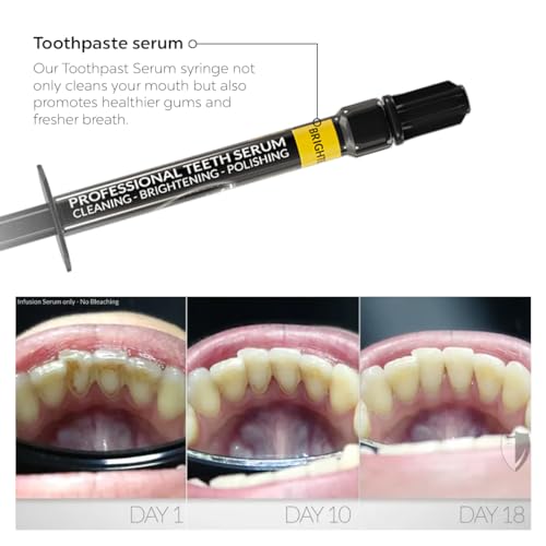 Image of Bilistic Pro-Series Tooth Polisher and Teeth Whitening Power Pack LED Light | Professional At-Home Polisher with Corded Handpiece and Detox Serum | Brighter Image Lab