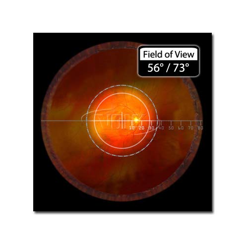 Volk Pan Retinal 2.2 Classic Bio Lenses- Silver #TOP1